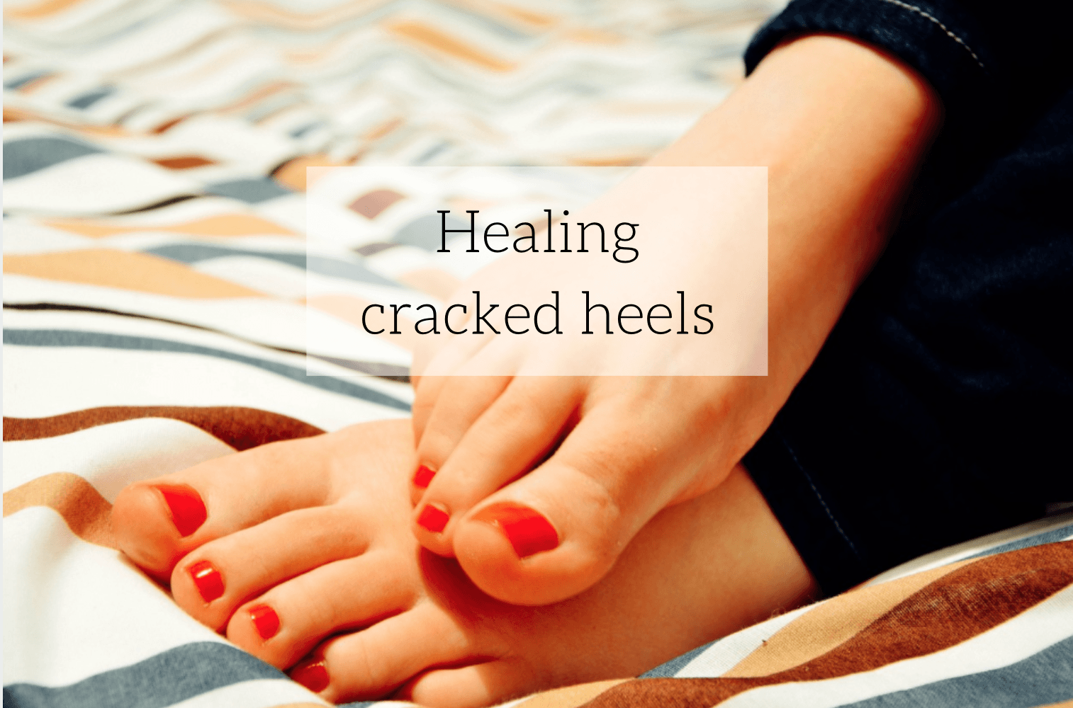 ayurvedic medicine for cracked heels