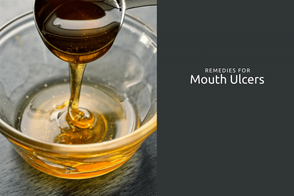 treatment of mouth ulcers in Ayurveda