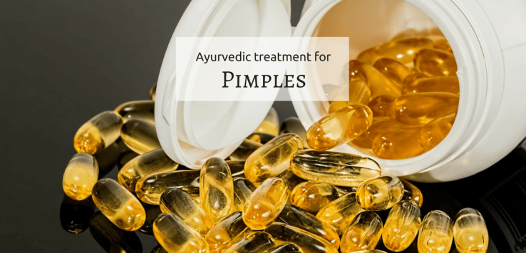 Ayurvedic treatment for pimples