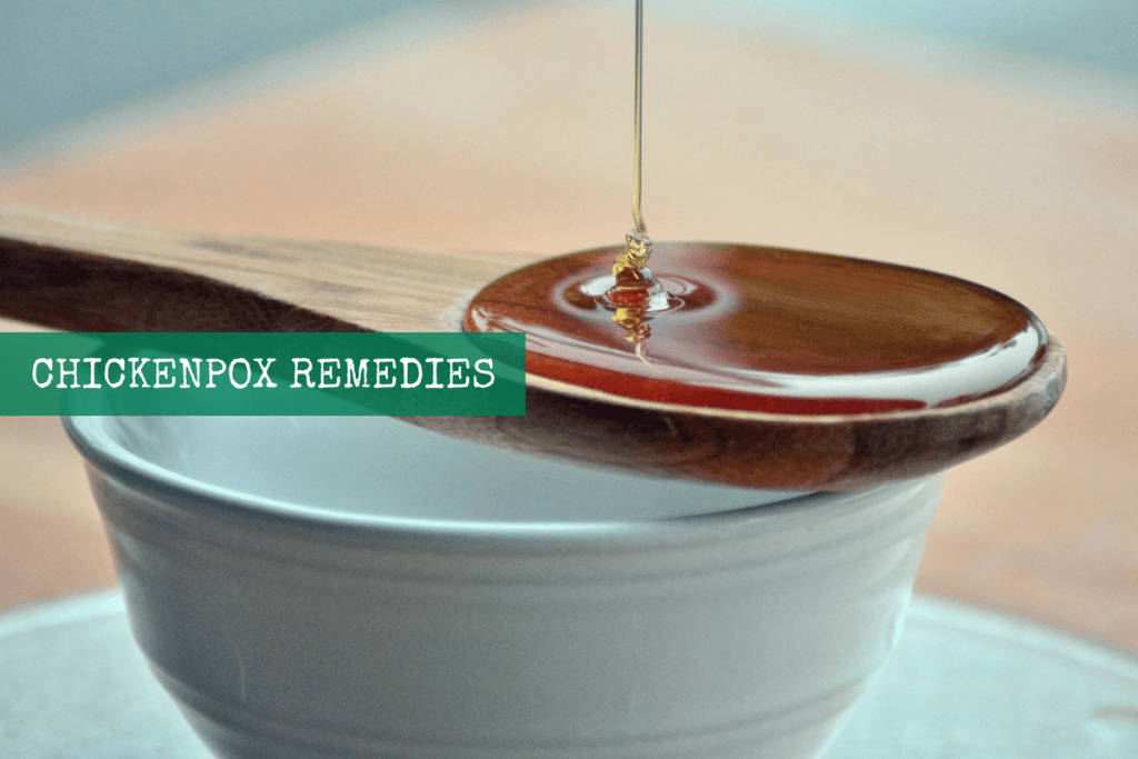 Home Remedies For Chickenpox