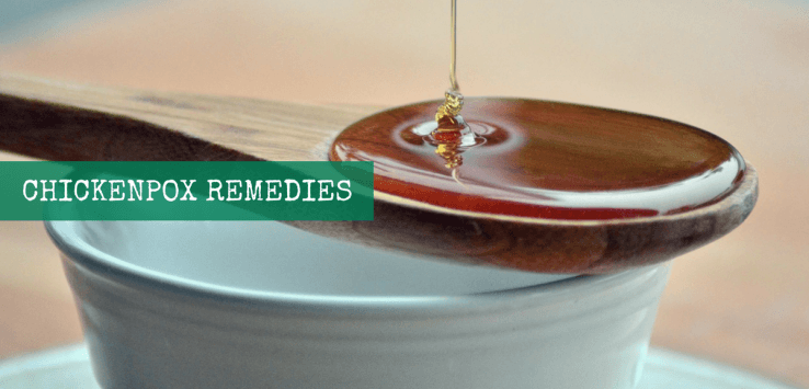 Home Remedies For Chickenpox