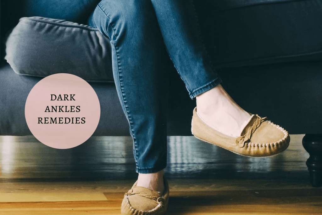 home remedies for dark ankles