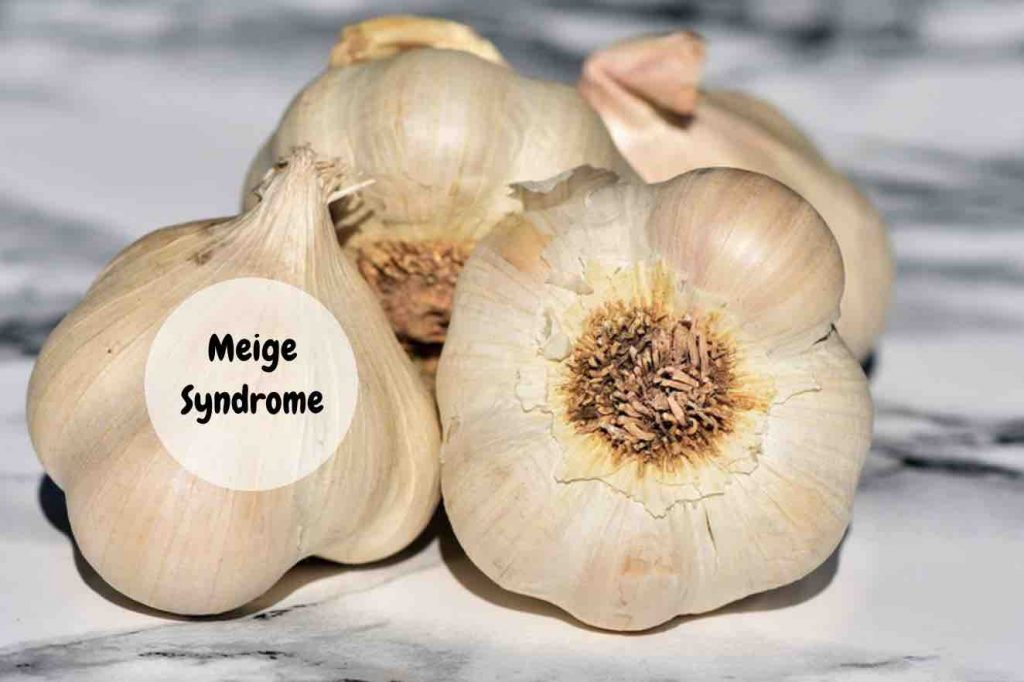 meige syndrome