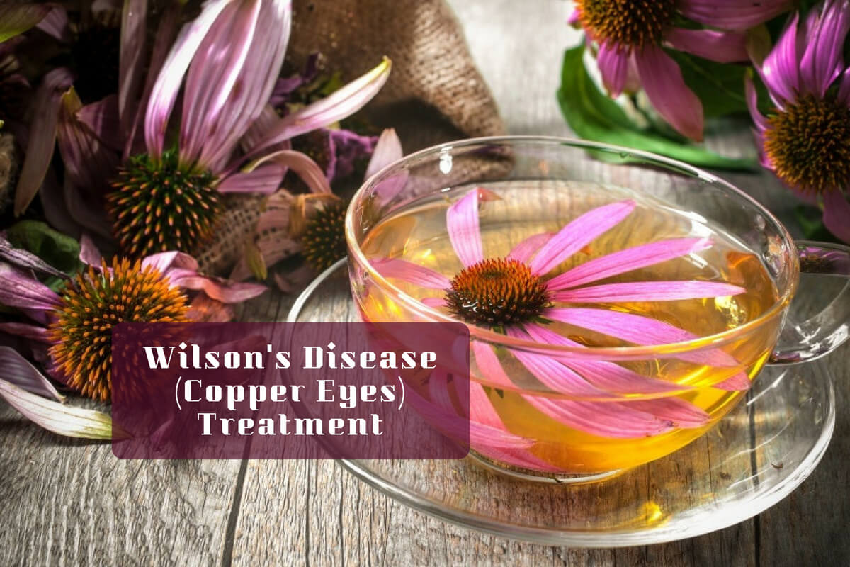 Wilson's Disease: What Is It And Is There An Effective Treatment?