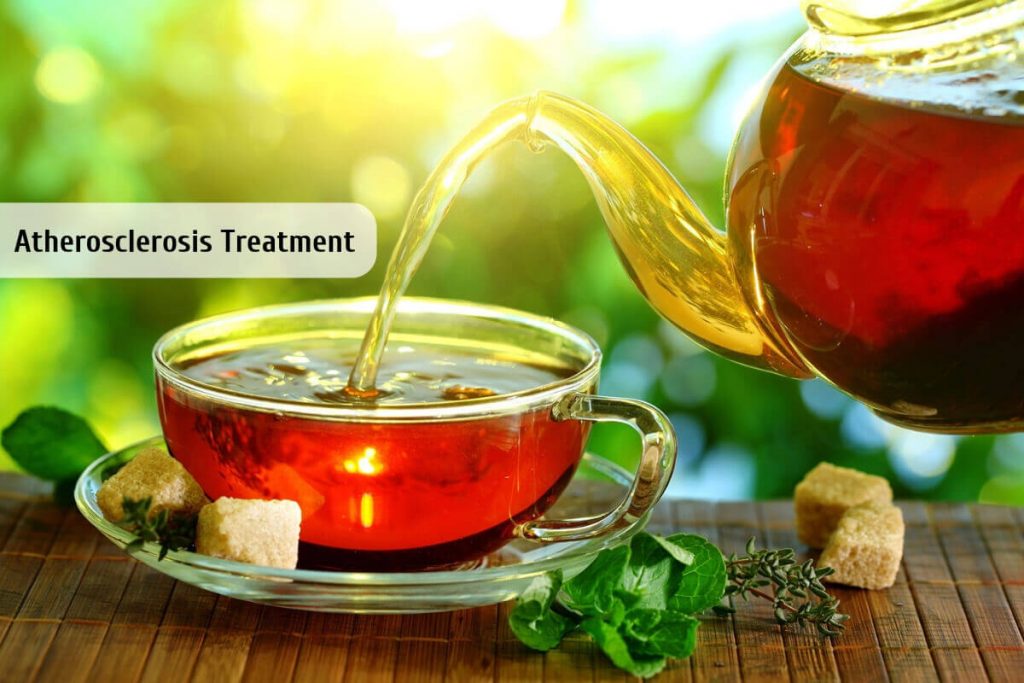 Atherosclerosis Treatment _ Ayurvedum