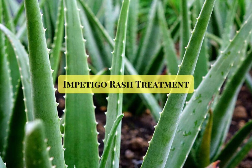 Impetigo treatment _ Ayurvedum