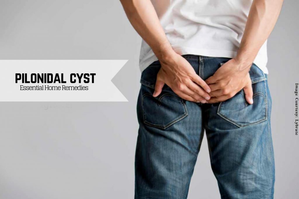 Pilonidal cyst _ Ayurvedum