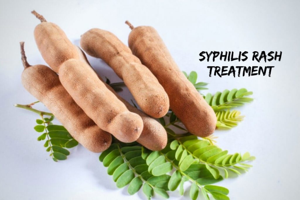 Syphilis rash treatment _ Ayurvedum