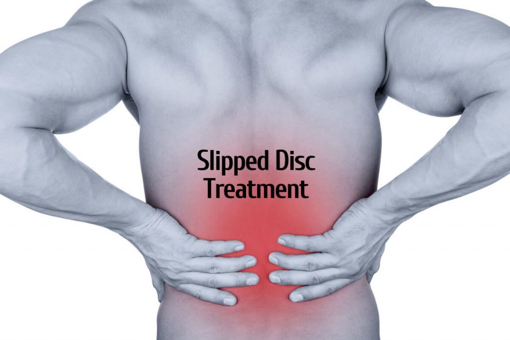 Slipped Disc treatment _ Ayurvedum (1)