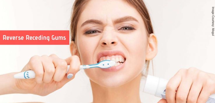 receding gums _ Ayurvedum