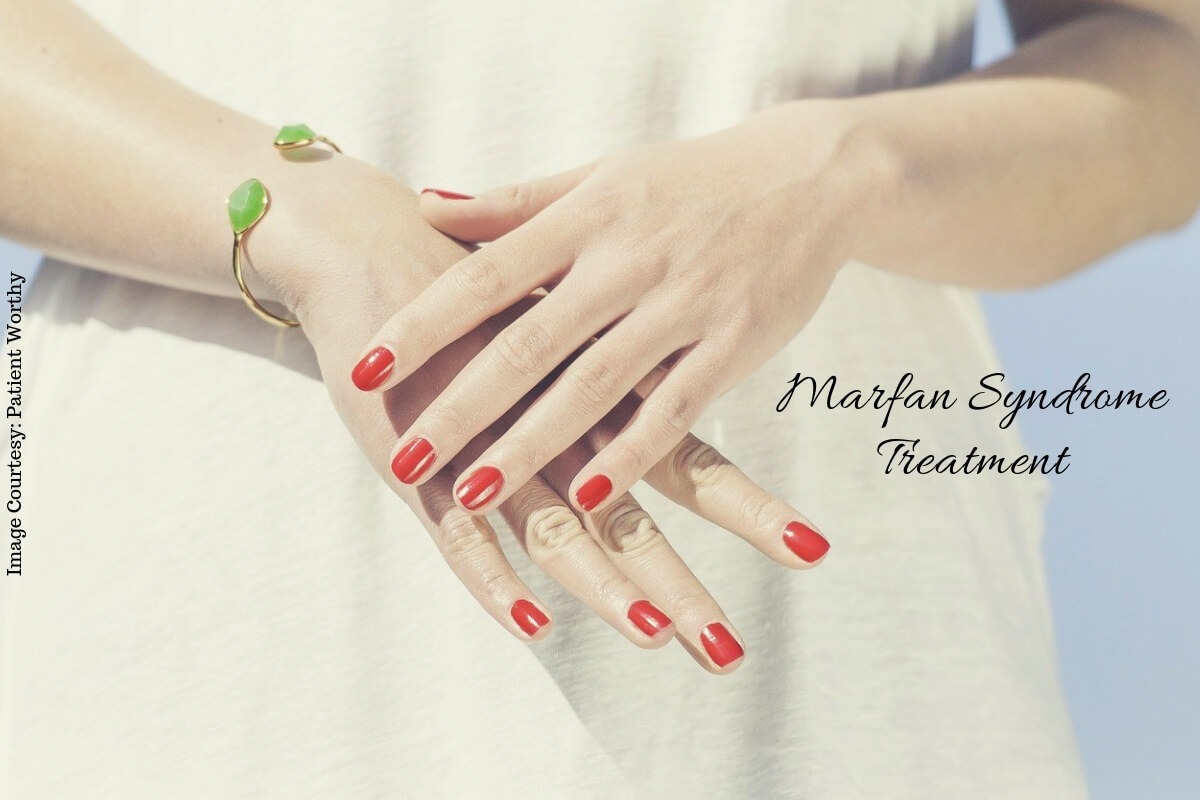 Marfan Syndrome Natural Treatment For The Connective