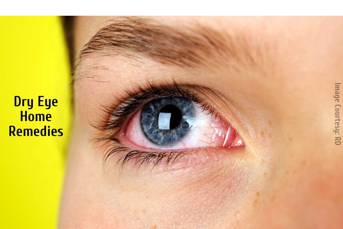 Dry Eyes Natural Home Remedies For The Dry Eyes Syndrome