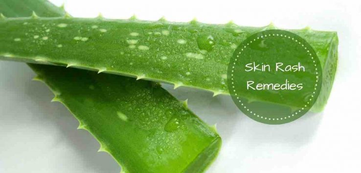 skin rashes remedy
